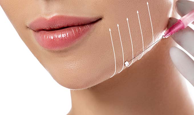 Patient being prepared to have their jawline improved by non-surgical facelift such as the Silhouette Face Lift or PDO Thread Lift provided by Mariya Kogan at White Mountain Med Spa.